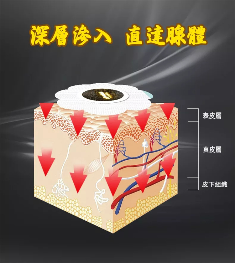 前列腺穴位貼 穴位敷貼 一貼見效、治療陽痿07.jpg